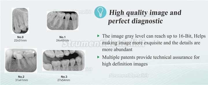 TYRIS CR-100 radiografia digitale ai fosfori sistema di elaborazione della scansione dentale